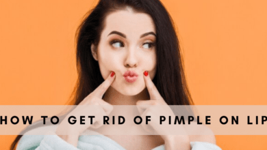 How to Get Rid of Pimple on Lip