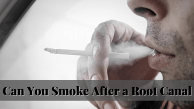 Can You Smoke After a Root Canal