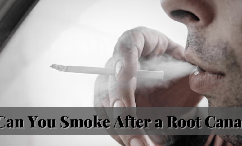 Can You Smoke After a Root Canal