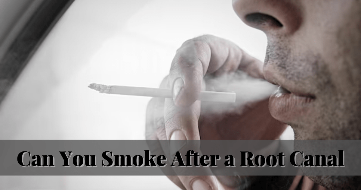 Can You Smoke After a Root Canal