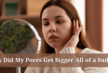 Why Did My Pores Get Bigger All of a Sudden