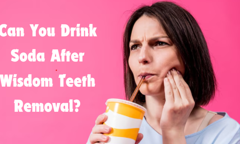 Can You Drink Soda After Wisdom Teeth Removal? Side Effects