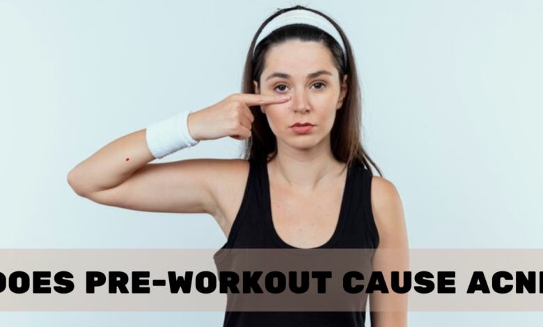 Does Pre-Workout Cause Acne